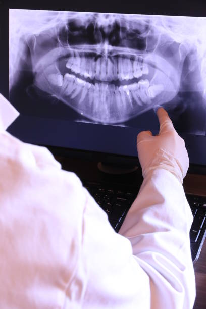 Best Knocked-Out Tooth (Avulsed Tooth) Treatment in Kingstowne, VA